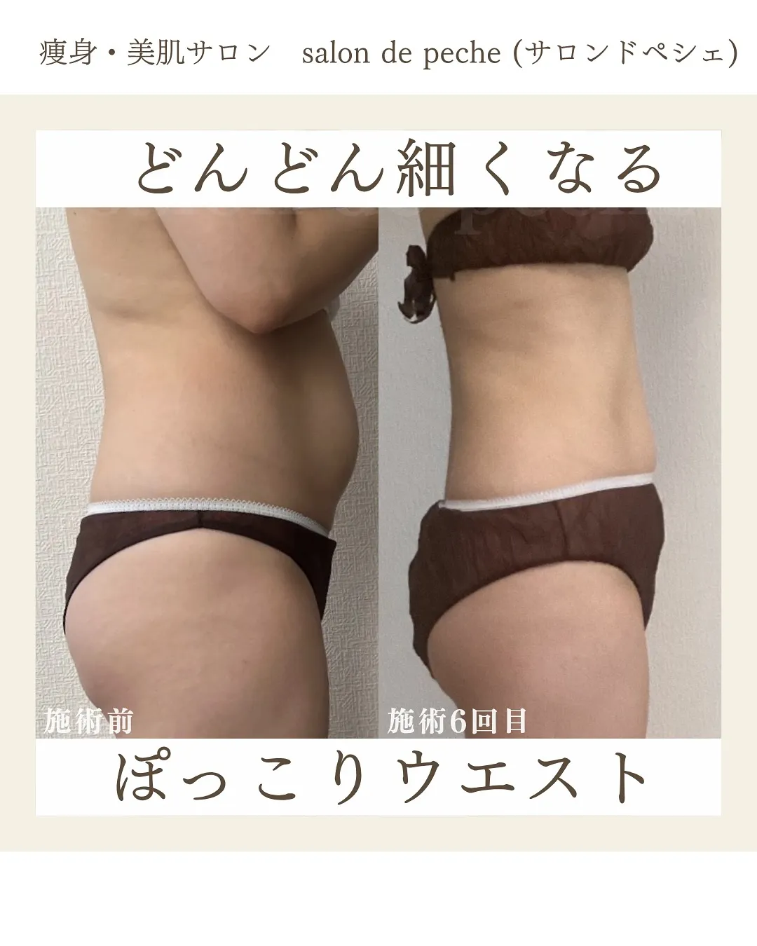 30代のお客様、痩身コース6回目の変化♪