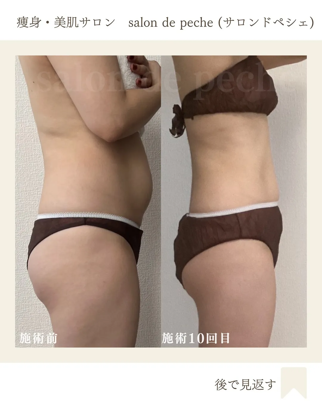 30代のお客様、痩身コース6回目の変化♪