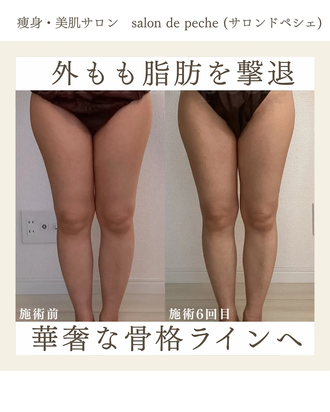 30代のお客様*6回での変化