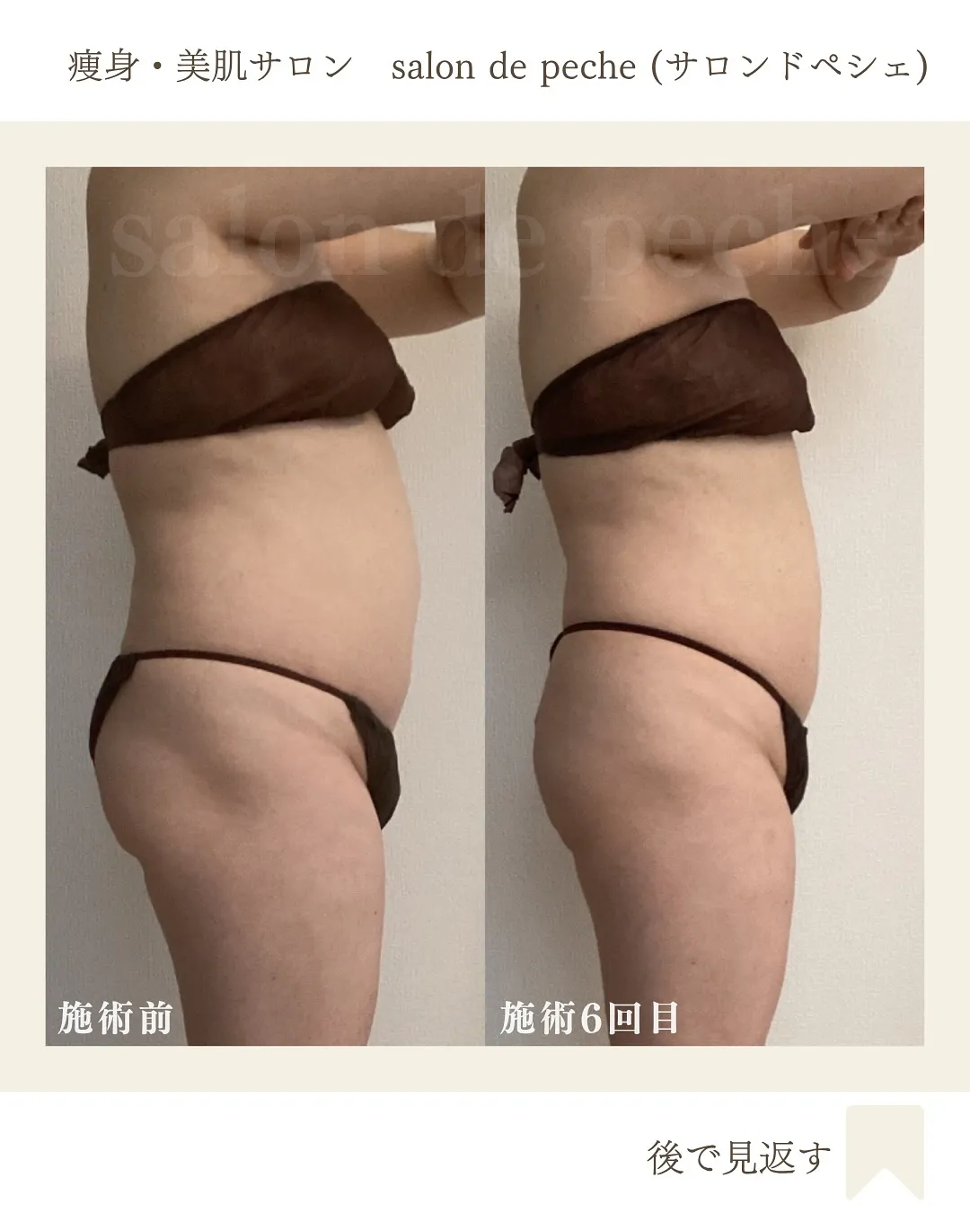 硬く張ったお腹も、内臓脂肪も撃退!【安佐南区/中筋/痩身】