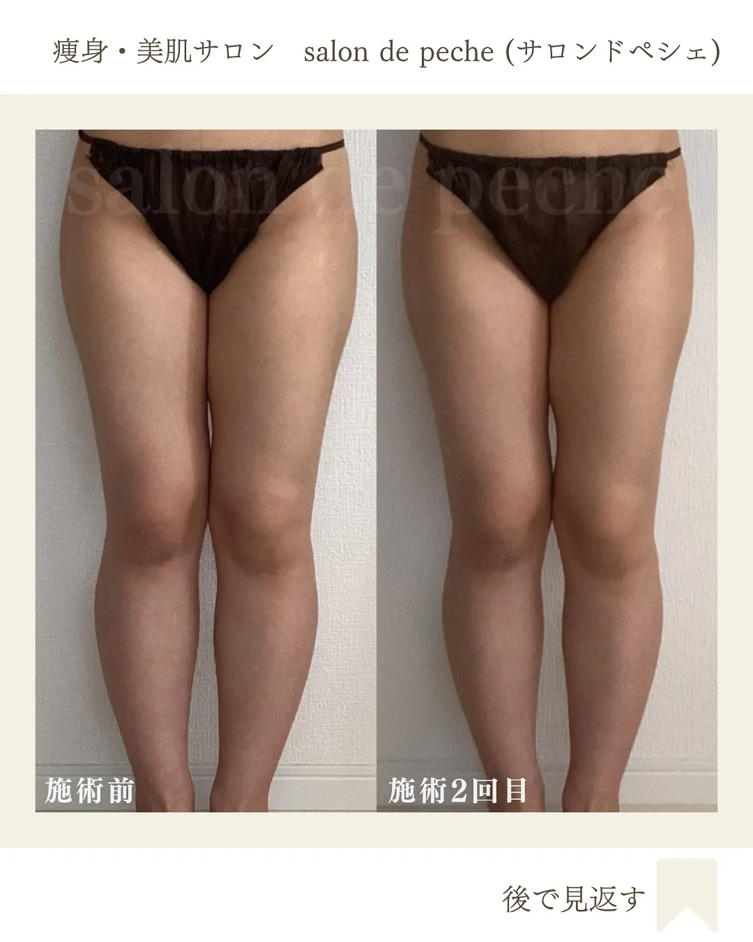内ももの隙間痩せ【安佐南区/足痩せ/内もも痩せ】