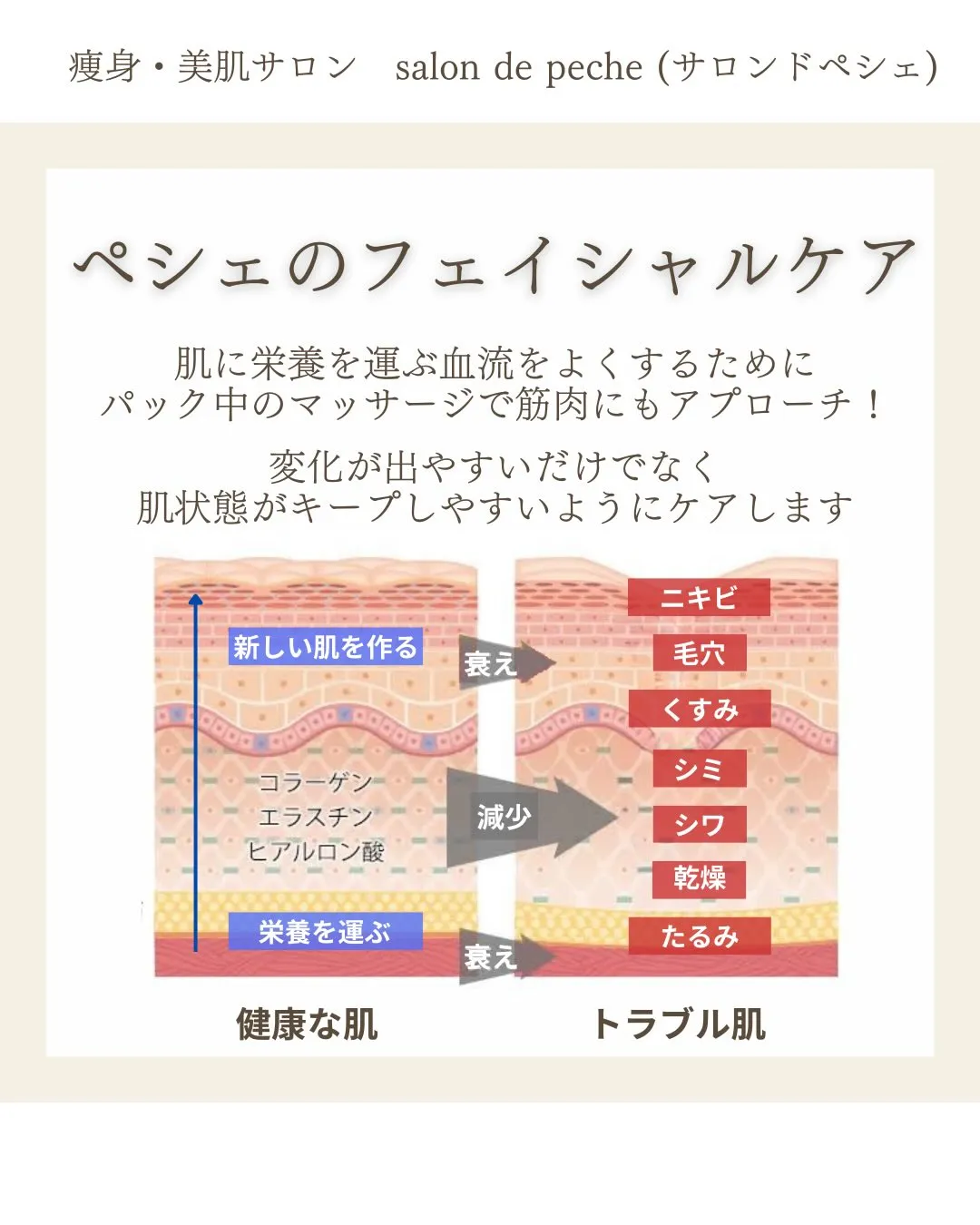 ハーブピーリング5回の変化【広島市/ニキビ/シミケア】