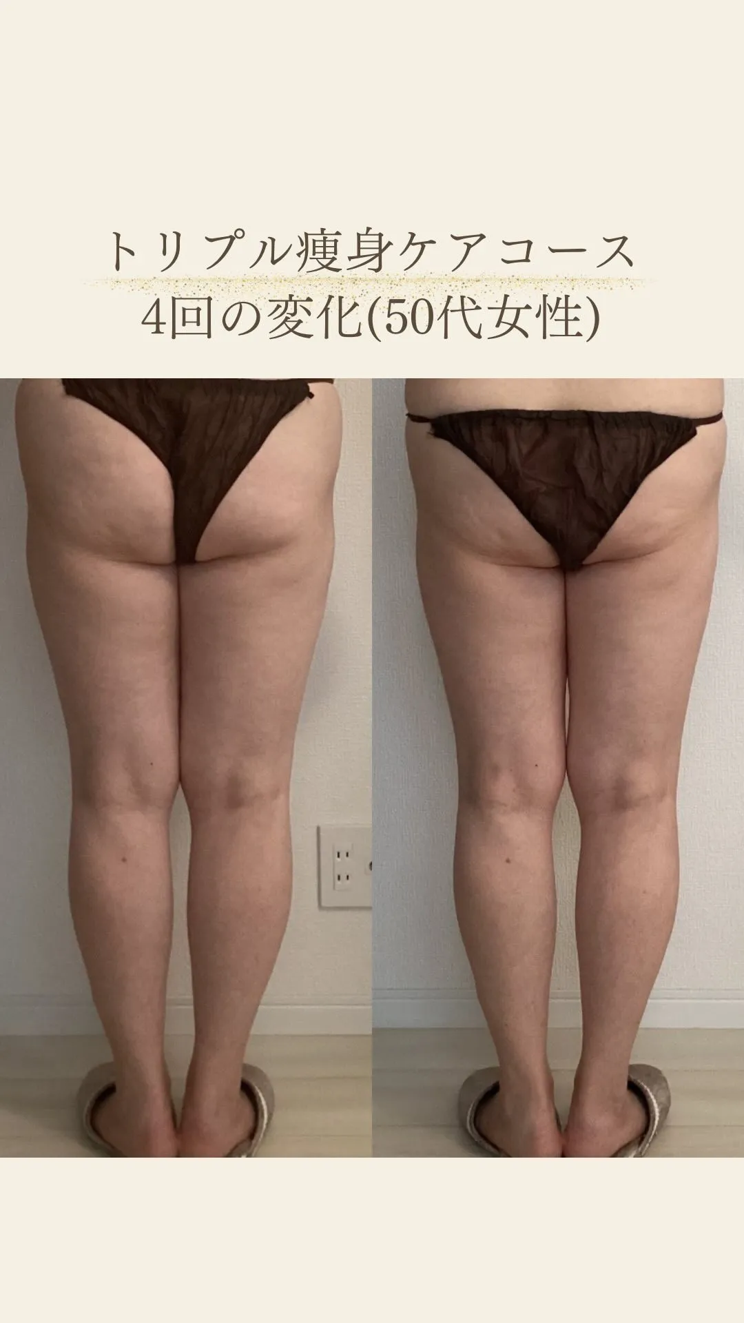 50代＊トリプル痩身ケアコース4回の変化